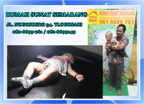 Tanggapan orang tua pasien setelah sunat di Rumah Sunat Semarang