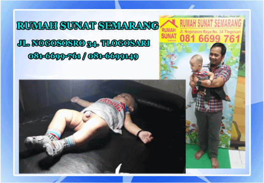 Tanggapan orang tua pasien setelah sunat di Rumah Sunat Semarang